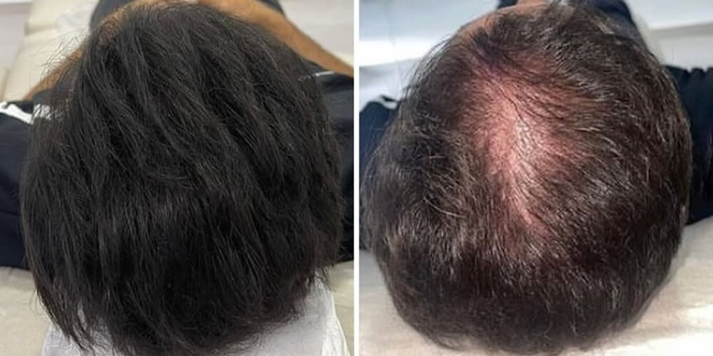 651197722_18115019500637307_5424840895176510620_n