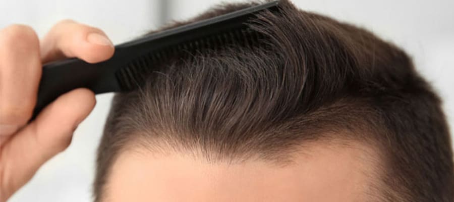 Tıraşsız Saç Ekimi