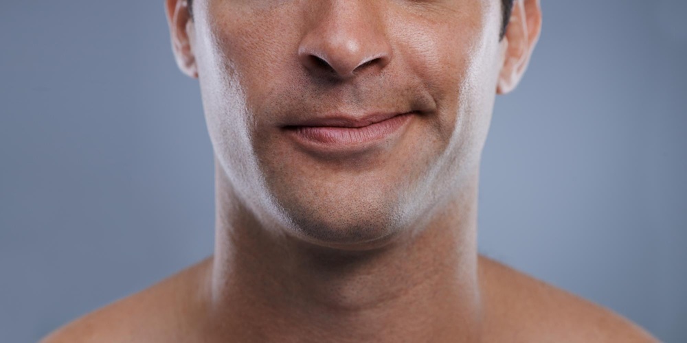 what-is-post-beard-transplant-shock-loss-what-causes-it-and-when-does-it-go-away-01_1